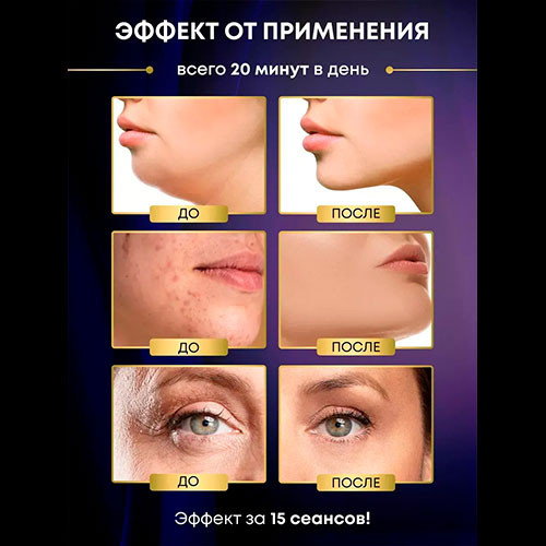 7 в 1 Массажер для лица с RF и EMS/Цв.:фиолетовый тип1 | MK02997